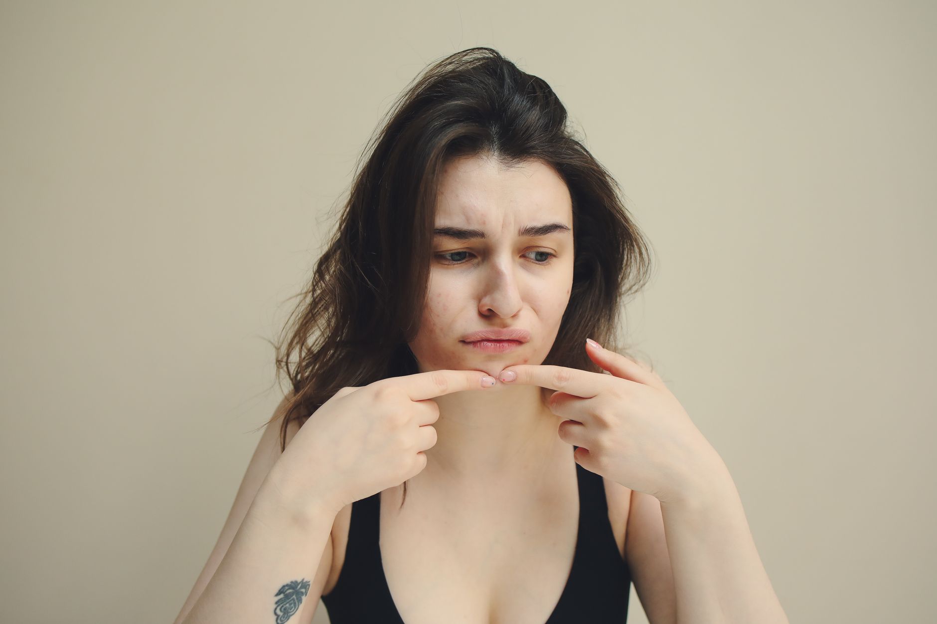 Acné chez l'adulte : les soins naturels qui m'ont aidé — Savonnerie du Manoir